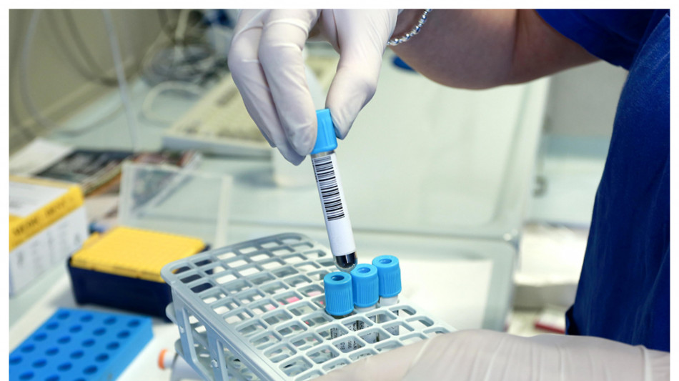 Anticorpi sentinella predicono chi risponder&agrave; meglio ai vaccini